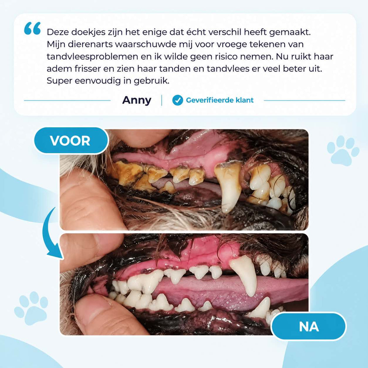 Tandenreiniging Vingerdoekjes