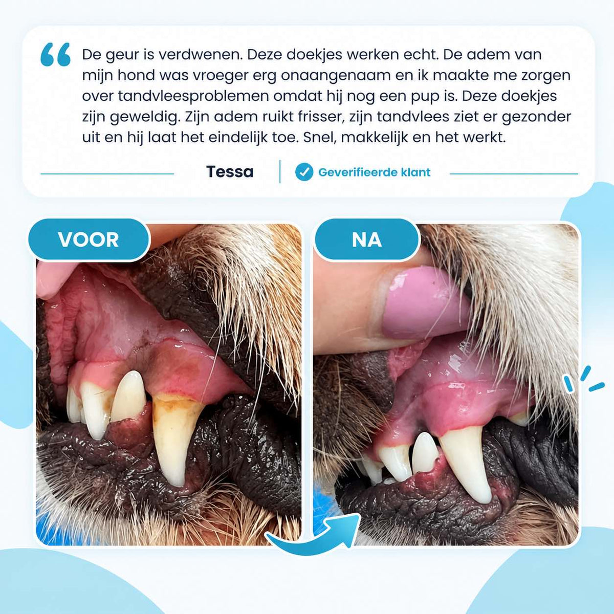 Tandenreiniging Vingerdoekjes